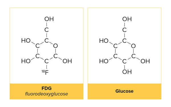 FDG og glucose   Clio